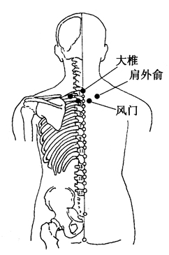 图3-2-3大椎、肩外俞、风门